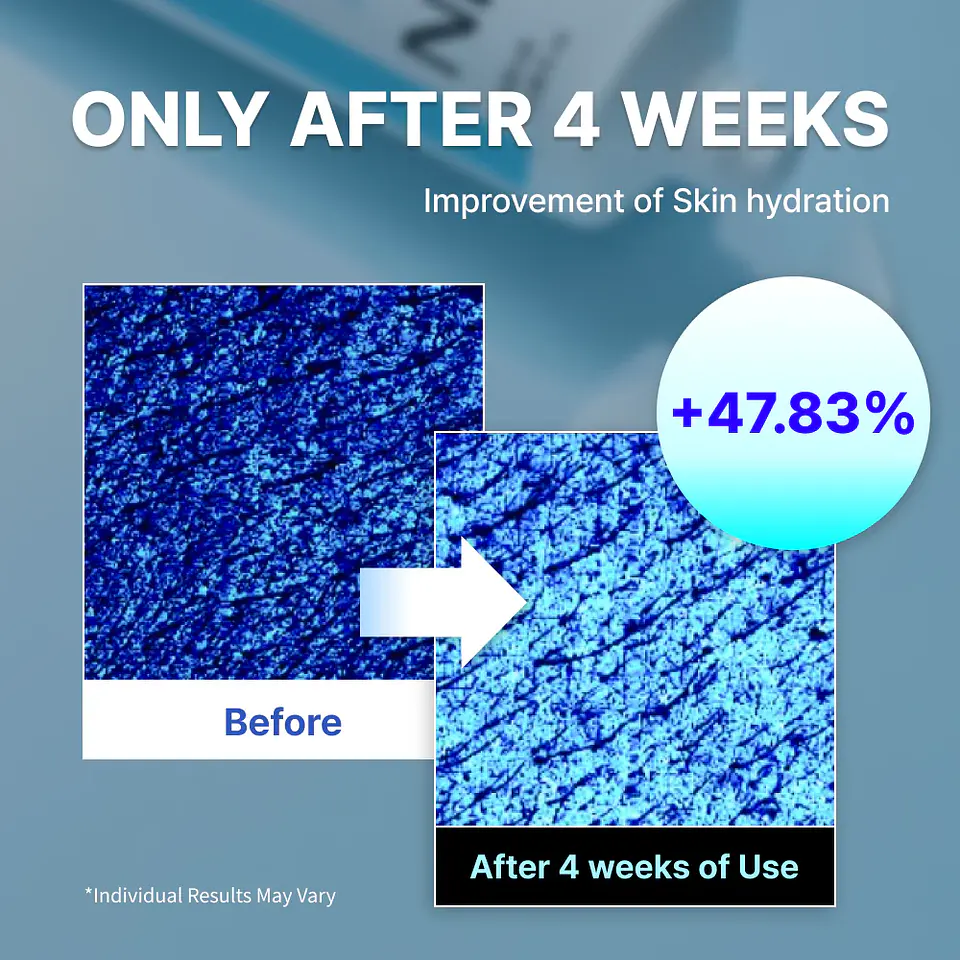 Youthful Formula™ Ultimate Moisturizing Cream (NIDA) - Crema antiedad con colágeno, péptidos, niacinamida y centella asiática 22