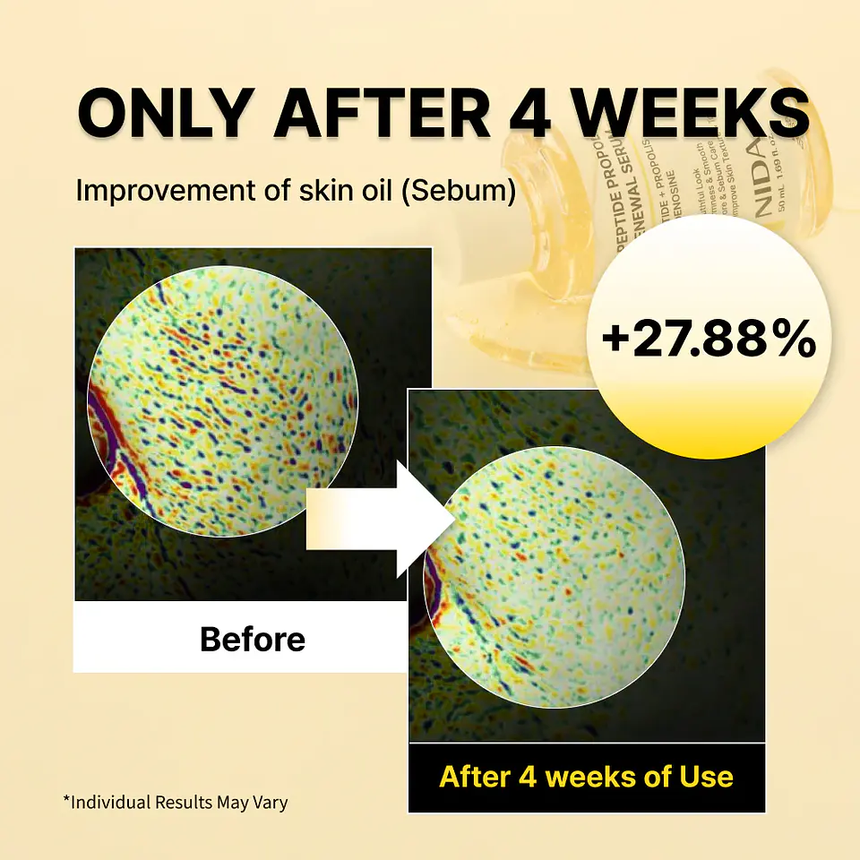 Peptide Propolis Renewal Serum (NIDA) -50ml Serum antiedad con propóleo y péptidos 10