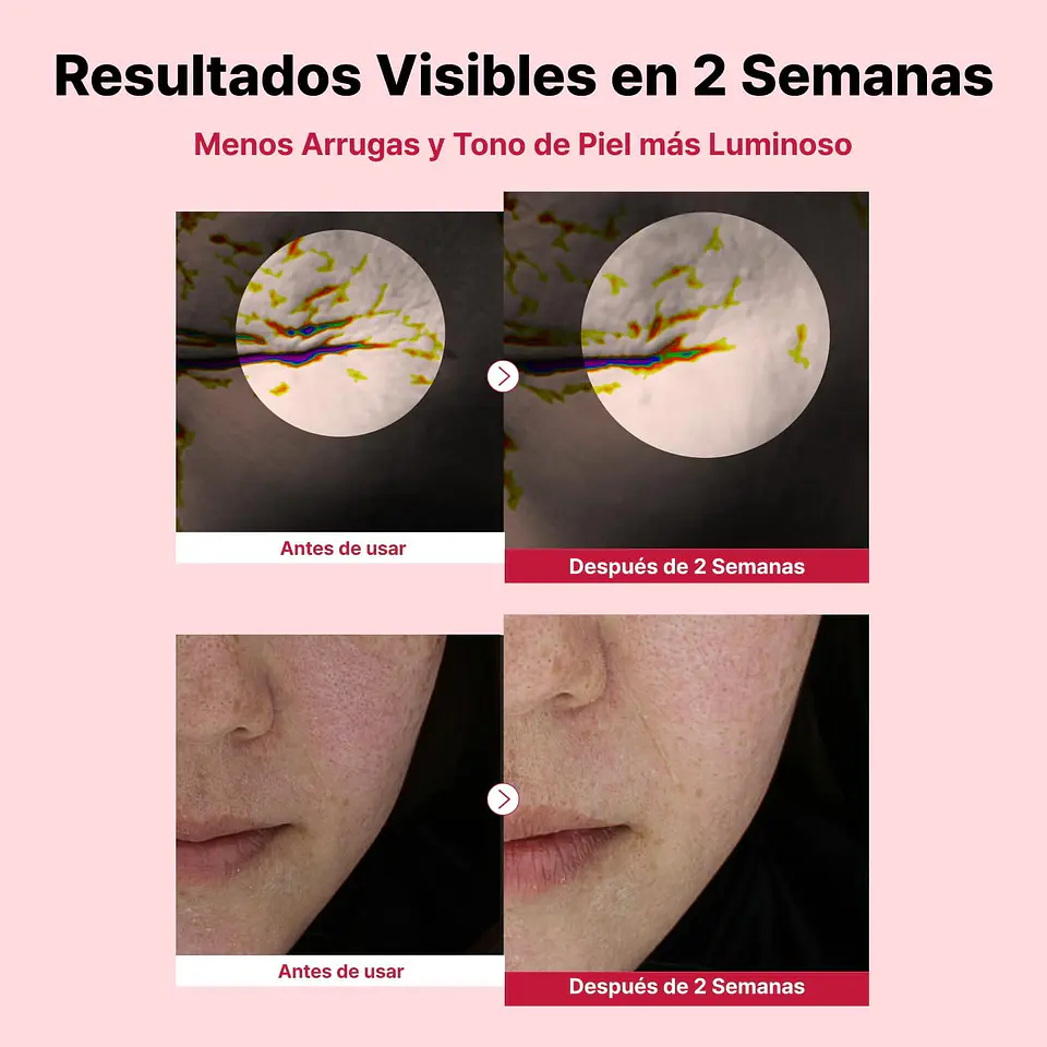 Youthful Formula™ Yam Mucin ABCE Boosting Serum (NIDA) - 50 ml Serum antiedad y regenerador con vitaminas A, B, C, E y retinal 7