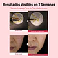 Youthful Formula™ Yam Mucin ABCE Cream (NIDA) - 55ml Crema antiedad y reparadora con vitaminas A, B, C y E y retinal - Miniatura 5