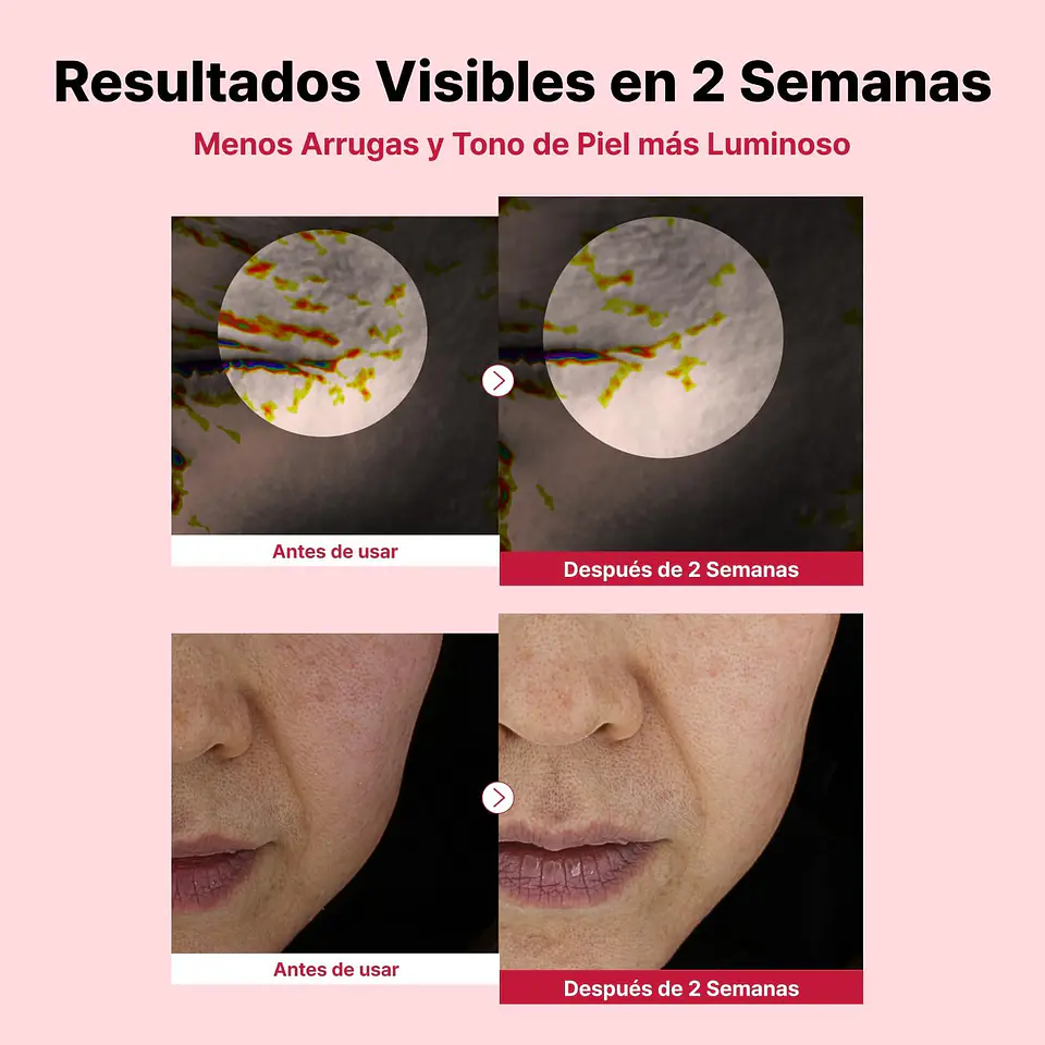 Youthful Formula™ Yam Mucin ABCE Cream (NIDA) - 55ml Crema antiedad y reparadora con vitaminas A, B, C y E y retinal 5