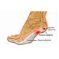 Talonera Fascitis Plantar - thumbnail 6