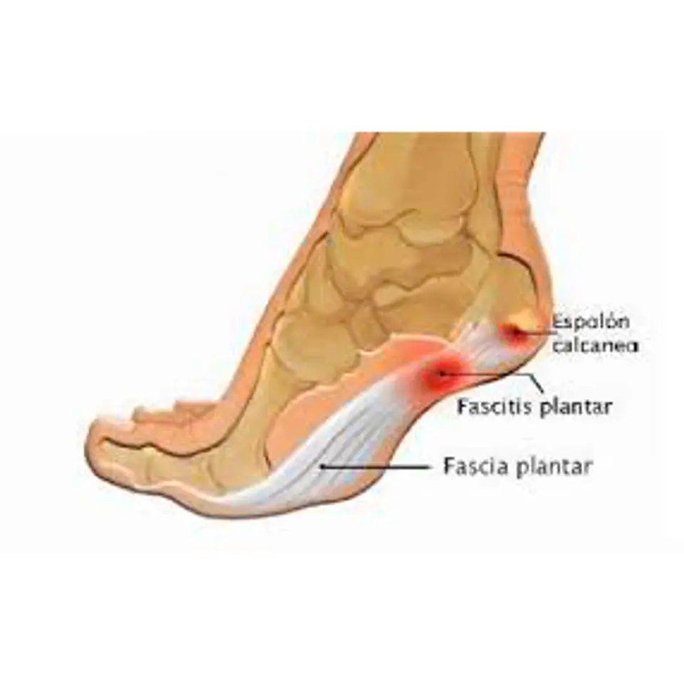 Talonera Fascitis Plantar 6