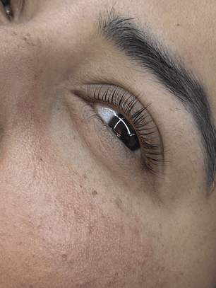 LIFTING + BOTOX + TINTE