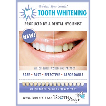 Teeth whitening