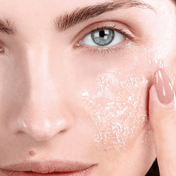 Peeling y acné