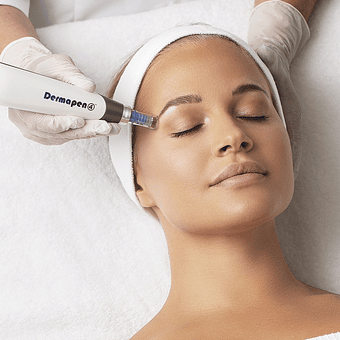 Micro-Needling (Dermapen)