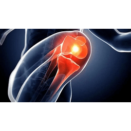 7 Parches Alivio De Dolor Instantaneo Para Deporte 10x14cm (ref 21687)