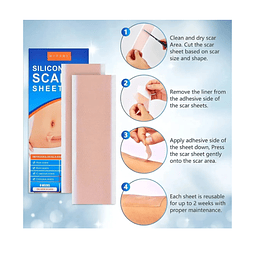 2 Parches De Silicona Para Cicatrices-queloides (ref 21220)