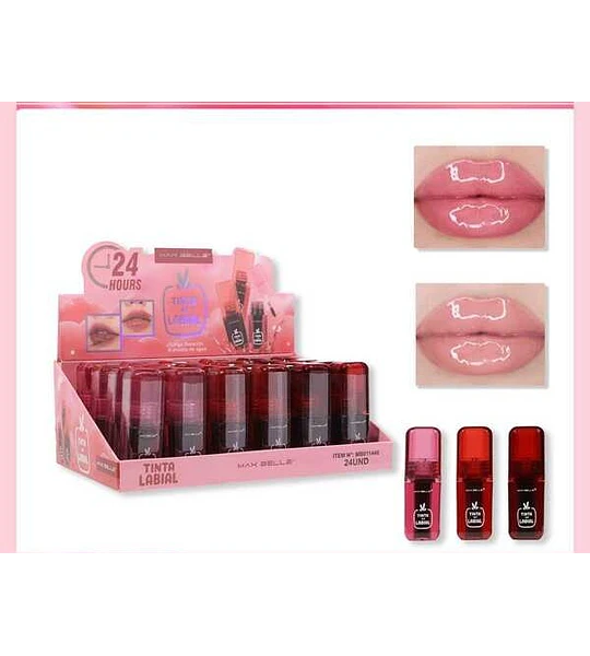 Labial