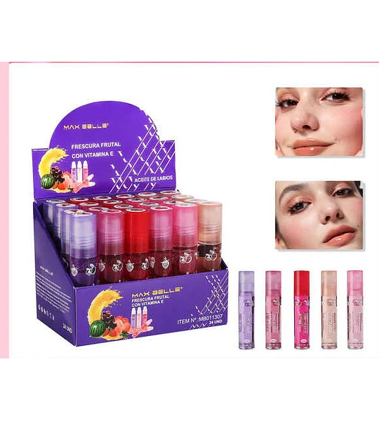 Labial
