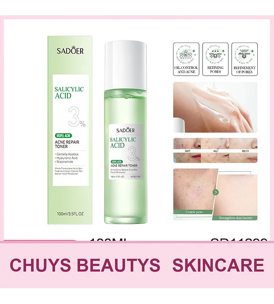 Tónico facial para el acné con ácido salicílico de SADOER 100ml