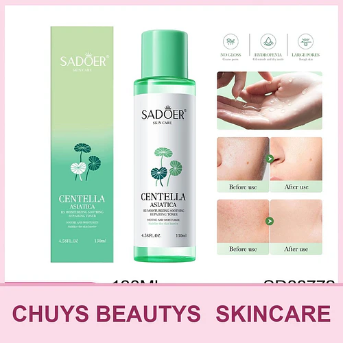 Tónico hidratante, calmante y reparador SADOER Centella Asiática B5 SADOER 130ml - Chuys Beautys | Chuy's Beautys