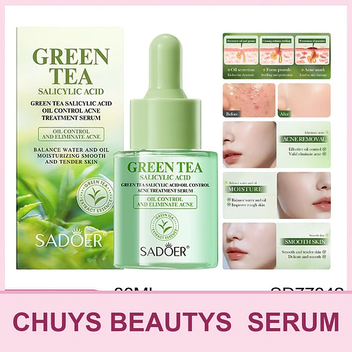 SADOER Sérum de té verde con ácido salicílico para el control de la grasa y el tratamiento del acné 30ml - Chuys Beautys | Chuy's Beautys