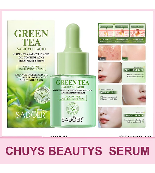 SADOER Sérum de té verde con ácido salicílico para el control de la grasa y el tratamiento del acné 30ml