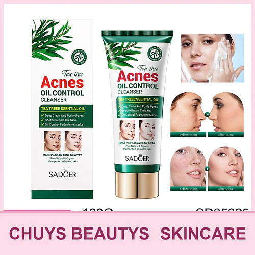 Limpiador facial SADOER con árbol de té para el control del acné y la grasa 100g - Chuys Beautys | Chuy's Beautys