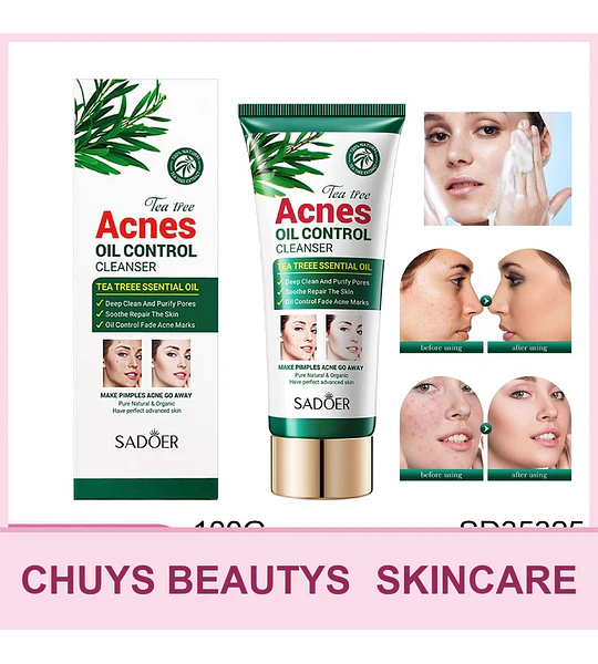 Limpiador facial SADOER con árbol de té para el control del acné y la grasa 100g