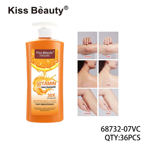 Loción Corporal Iluminadora Kiss Beauty con Vitamina C y Niacinamida Anti-Manchas 30X - Chuys Beautys | Chuy's Beautys