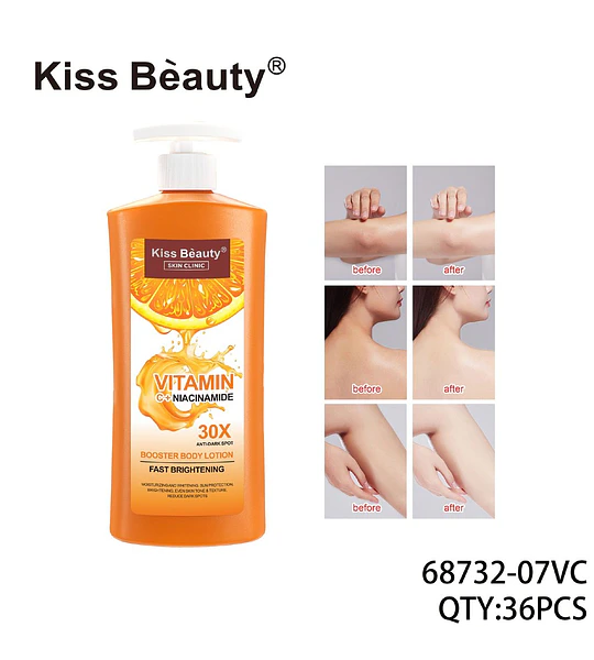 Loción Corporal Iluminadora Kiss Beauty con Vitamina C y Niacinamida Anti-Manchas 30X