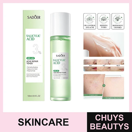 Tónico facial para el acné con ácido salicílico de SADOER 100ml - Chuys Beautys | Chuys Beautys