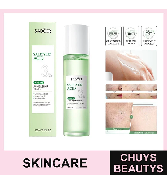 Tónico facial para el acné con ácido salicílico de SADOER 100ml