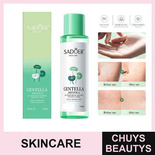 Tónico hidratante, calmante y reparador SADOER Centella Asiática B5 SADOER 130ml - Chuys Beautys | Chuys Beautys