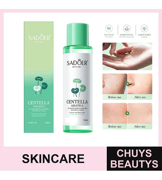 Tónico hidratante, calmante y reparador SADOER Centella Asiática B5 SADOER 130ml