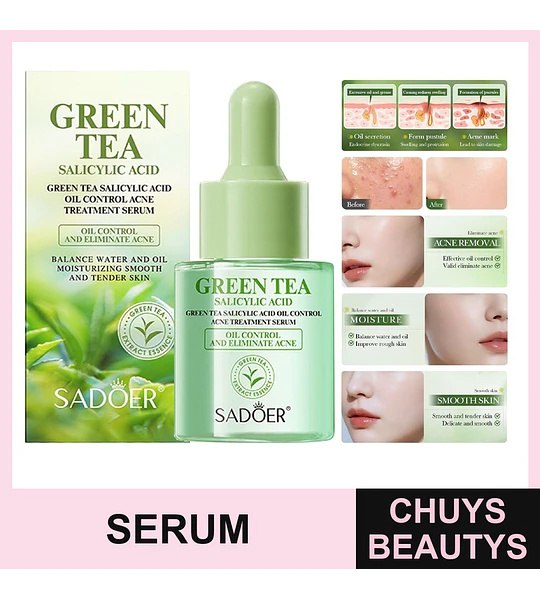 SADOER Sérum de té verde con ácido salicílico para el control de la grasa y el tratamiento del acné 30ml