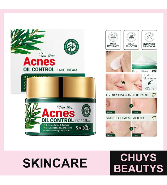 Crema SADOER para el control del acné con árbol de té 50g