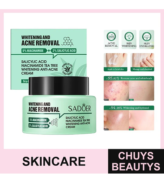 Crema Blanqueadora Antiacné Con Ácido Salicílico, Niacinamida y Árbol de Té De 50g