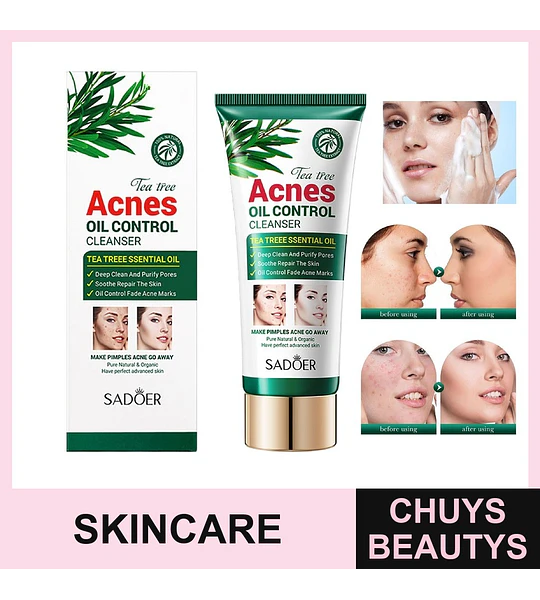 Limpiador facial SADOER con árbol de té para el control del acné y la grasa 100g