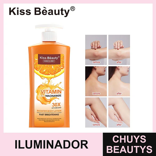 Loción Corporal Iluminadora Kiss Beauty con Vitamina C y Niacinamida Anti-Manchas 30X - Chuys Beautys | Chuys Beautys