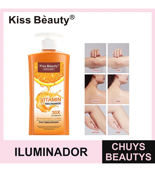 Loción Corporal Iluminadora Kiss Beauty con Vitamina C y Niacinamida Anti-Manchas 30X