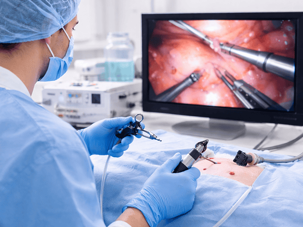 Esterilización minima invasiva con Laparoscopía: ¿Por qué es una mejor opción?