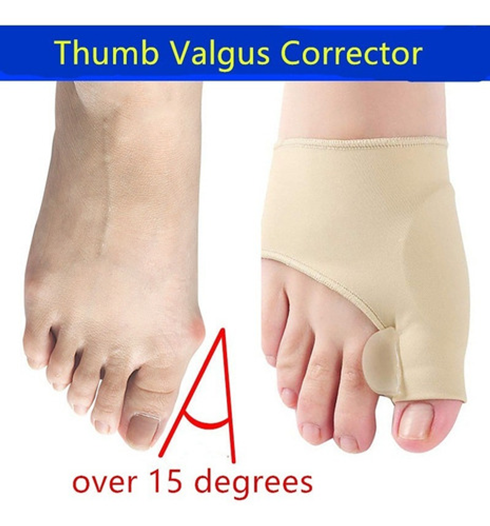 Calcentin Corrector De Juanetes Protector Enderezador 4