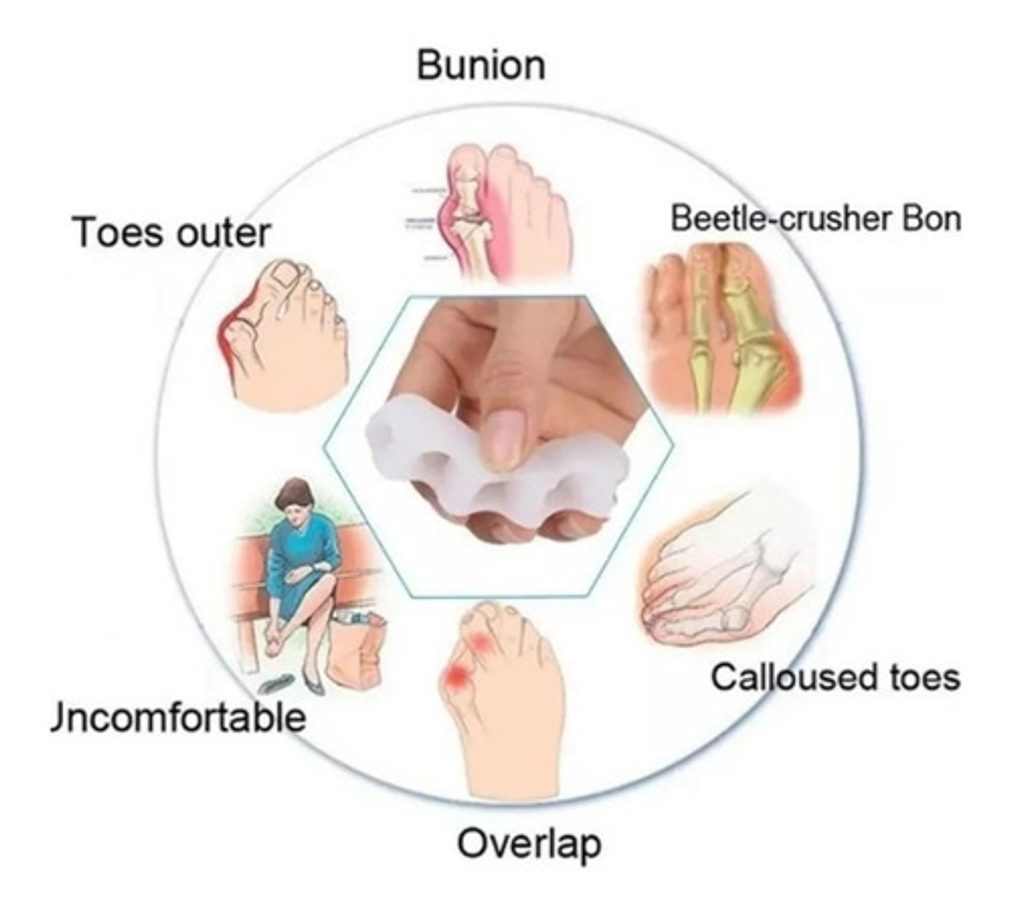 Pack X2 Separador De Dedos Ortopédico Color Blanco Talla Estándar 2