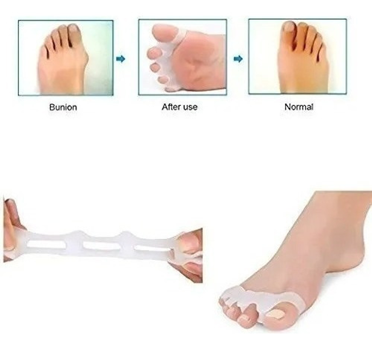 Separador Dedos Pie Corrector Juanete Protector Silicona Par 3