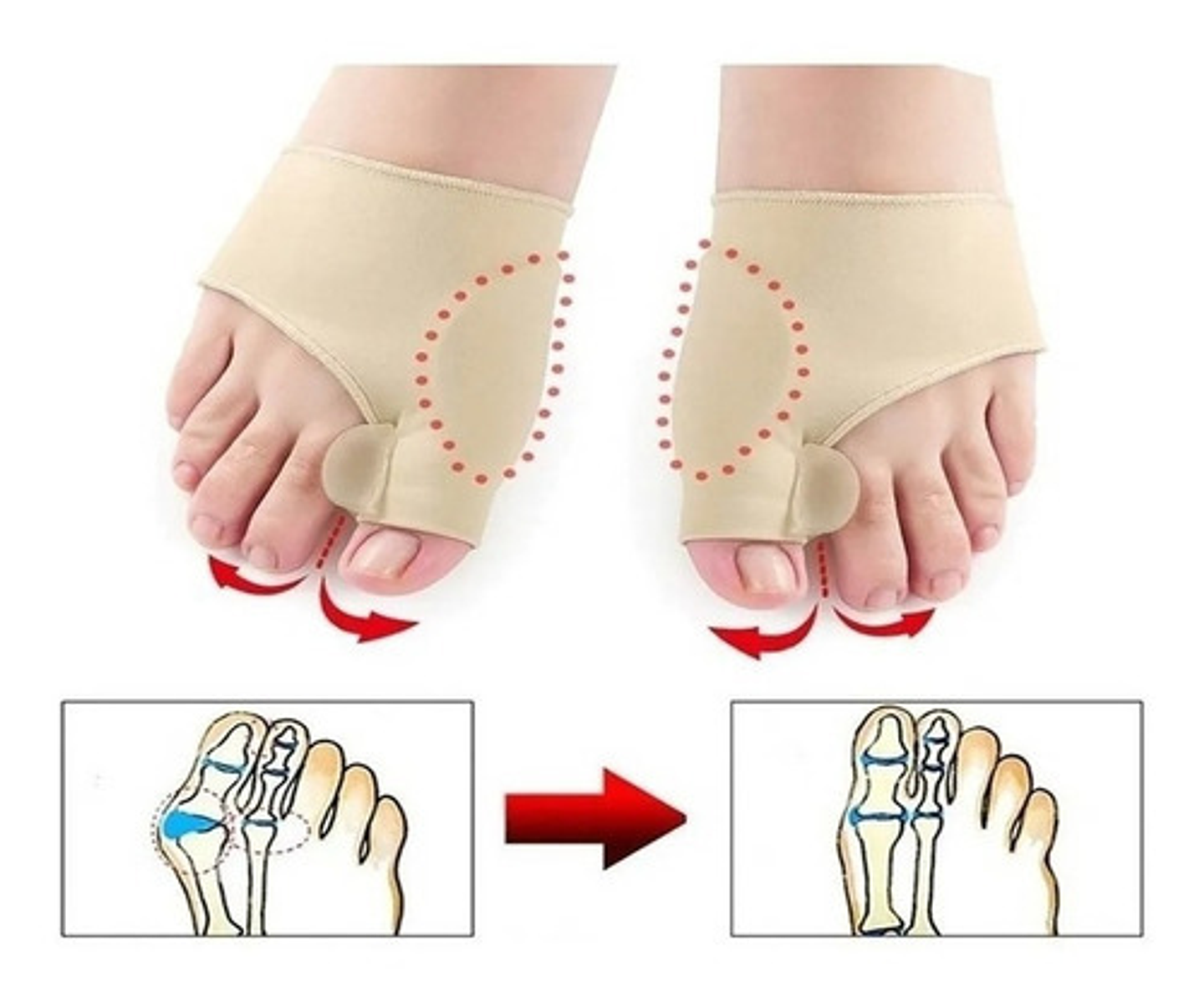 Calcetines Correctores Juanetes Gel Bealty Star Beige Silicona Ajustables 9