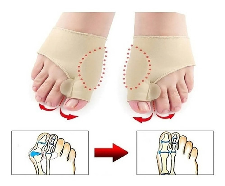 Calcetines Correctores Juanetes Gel Bealty Star Beige Silicona Ajustables 9