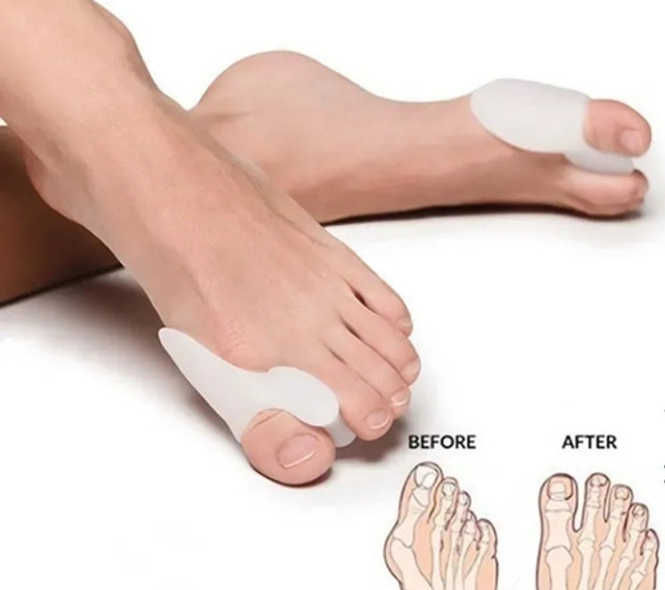 Corrector De Juanete Para Ambos Pies De Silicona Talla Están 2