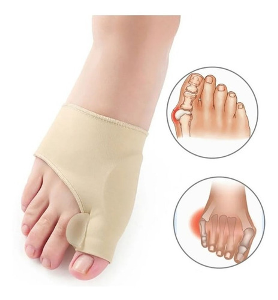 Corrector De Juanetes Con Gel Médico [1 Par Ambos Pies] 3