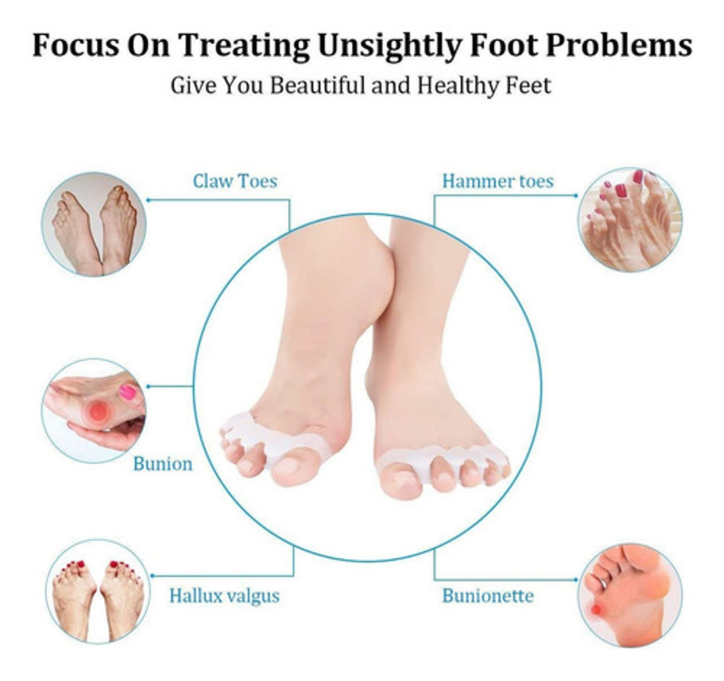 Separador Dedos Pie Silicona Marin Corrector Juanete Almohadilla Pack Blanco 4