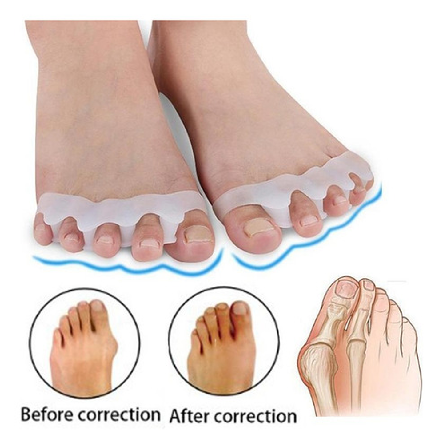 Separador Dedos Pie Silicona Marin Corrector Juanete Almohadilla Pack Blanco 5