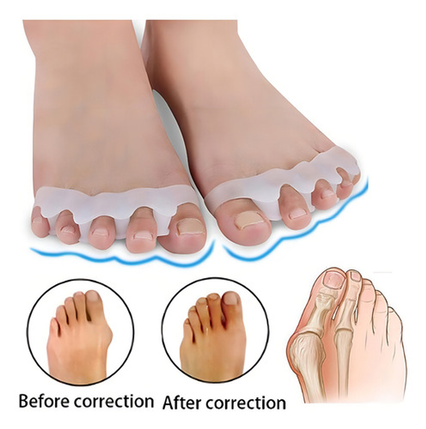 Separador Dedos Pie Silicona Marin Corrector Juanete Almohadilla Pack Blanco 5