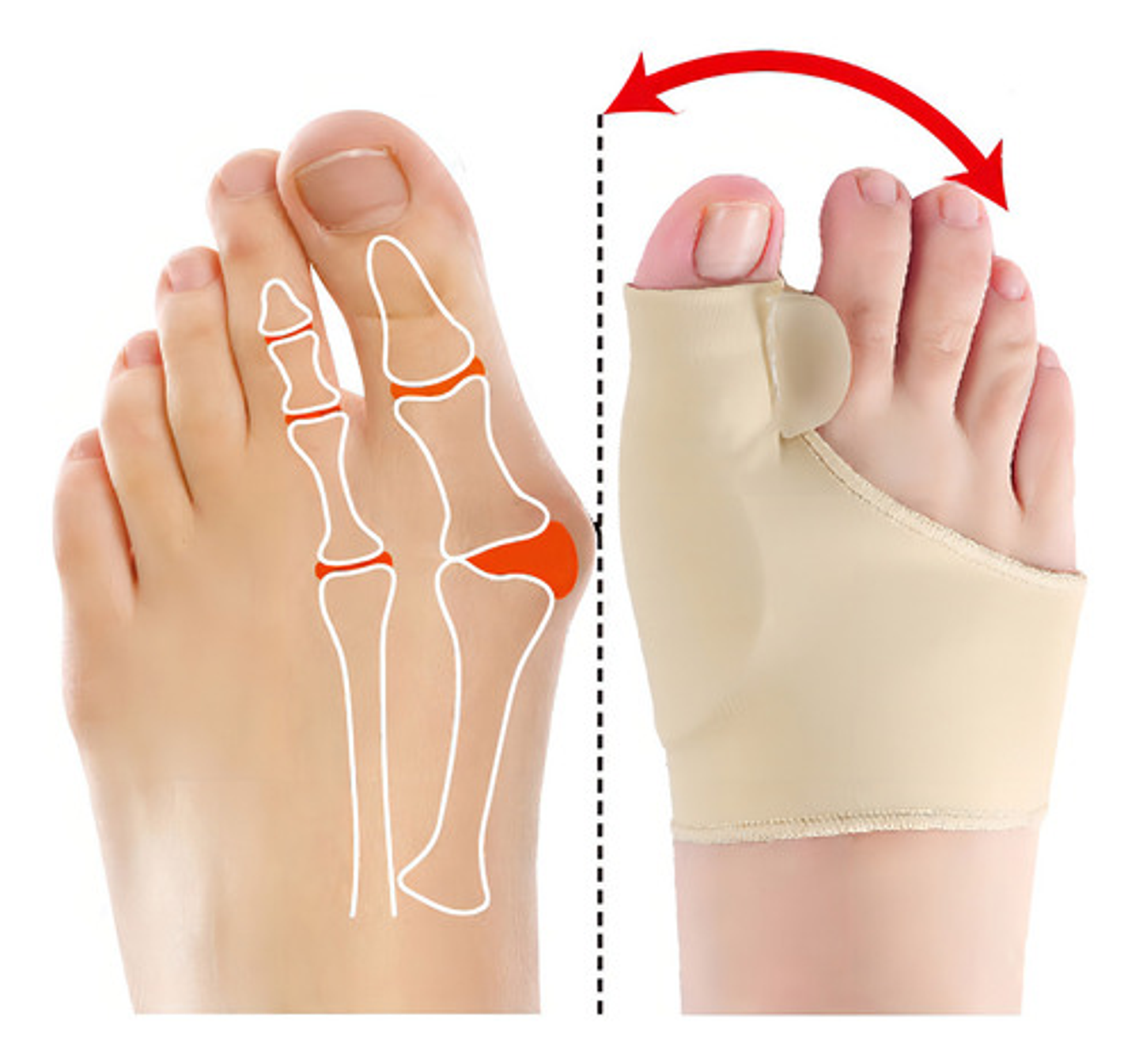 Corrector De Juanetes Separador Dedos Alivia Dolor Corrector Vhex Beige 2