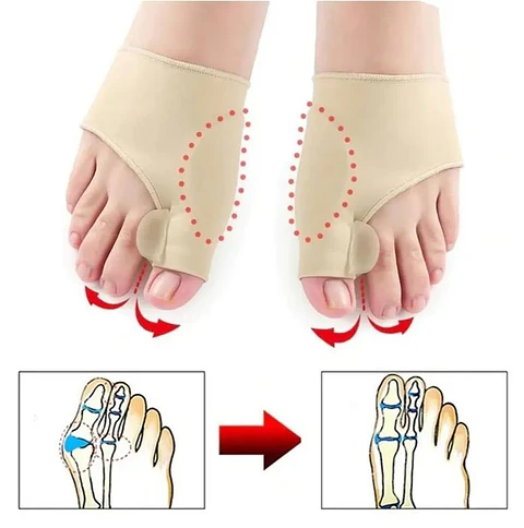 Corrector de juanetes Hallux Valgus