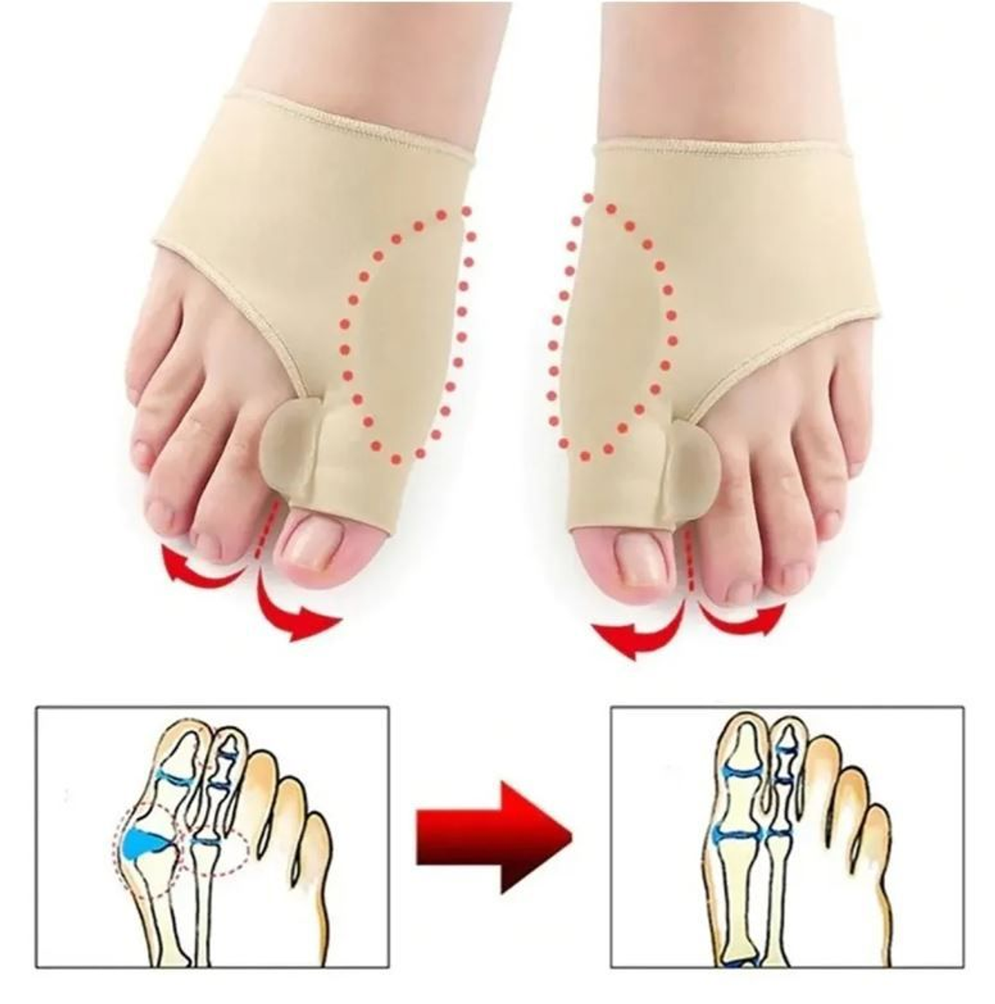 Corrector de juanetes Hallux Valgus 1