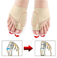 Corrector de juanetes Hallux Valgus - Miniatura 1
