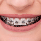 CASO BRACKETS METÁLICOS ADVANCED SERIES ORTHOMETRIC 2