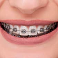CASO BRACKETS METÁLICOS ADVANCED SERIES ORTHOMETRIC - Miniatura 2